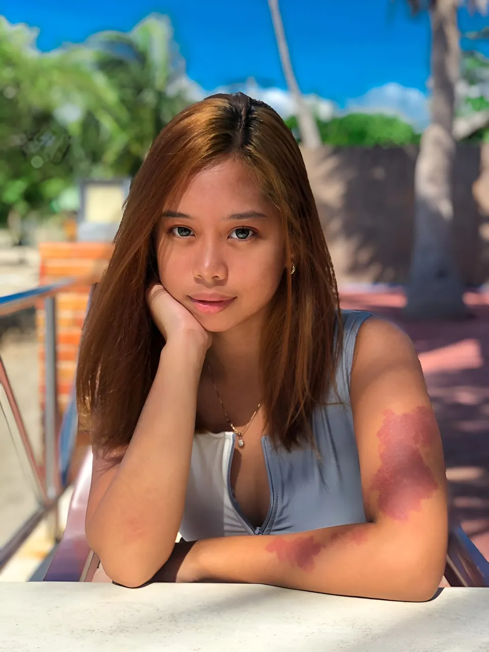 Ally Romano wearing a light blue top rests their chin on one hand outdoors